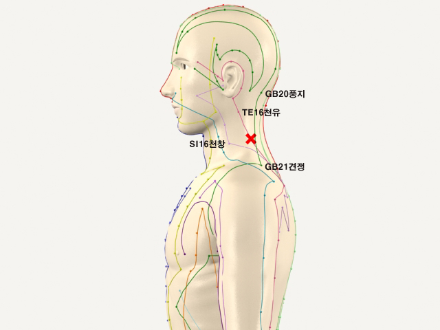 ���������(������������1)_L 통증유발점
