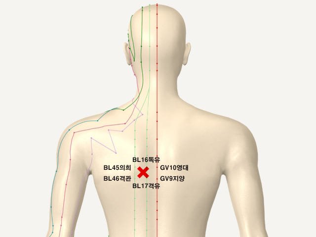 ���������(������������3)_��� 통증유발점