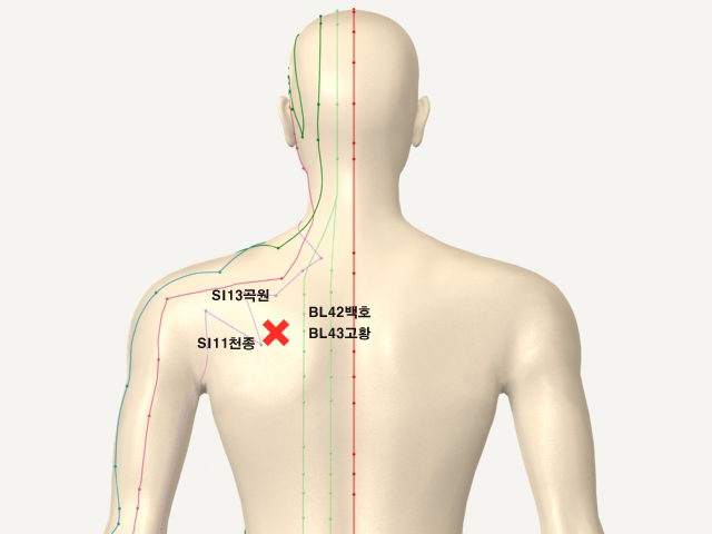 ���������(������������4)_��� 통증유발점