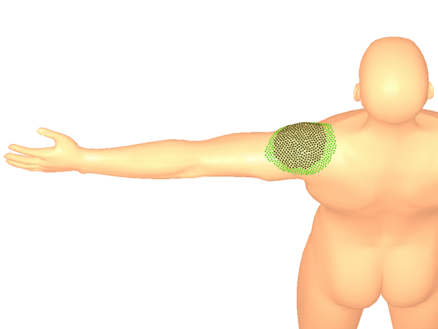 극상근(힘줄)_좌