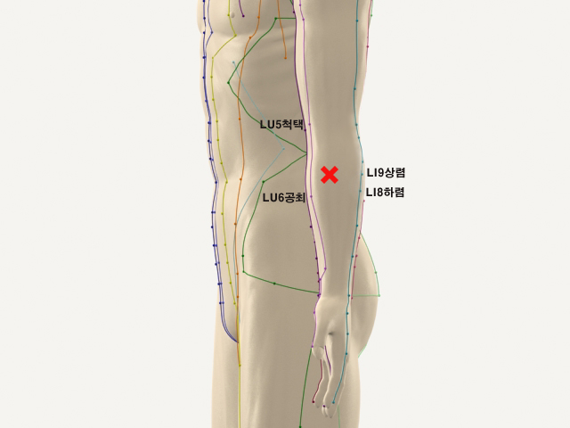 ������������_��� 통증유발점