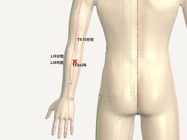 ���������������(������)_��� 통증유발점