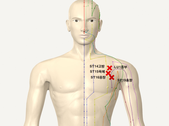 ���������(���������)_��� 통증유발점
