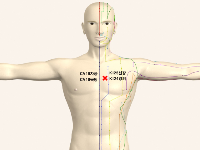 ���������_��� 통증유발점