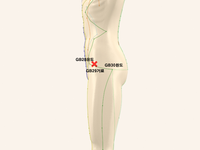 ������������������_��� 통증유발점