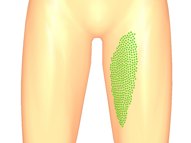 봉장근(중방아쇠점)_좌