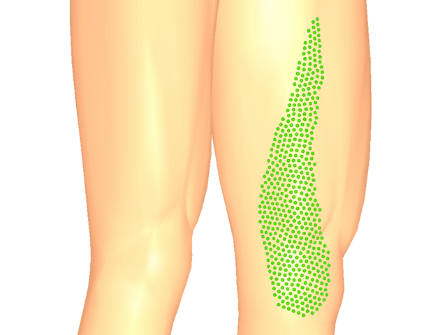 봉장근(하방아쇠점)_좌