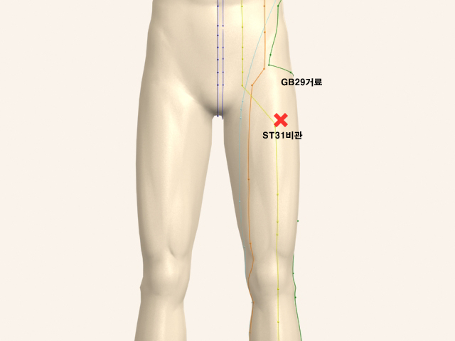������������_��� 통증유발점