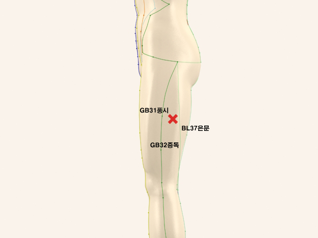  통증유발점
