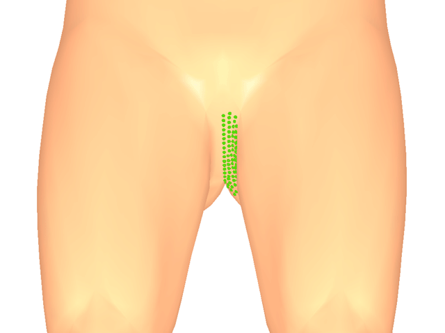 대내전근(방아쇠점2)_좌