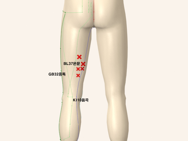 ��������������� ������������_��� 통증유발점