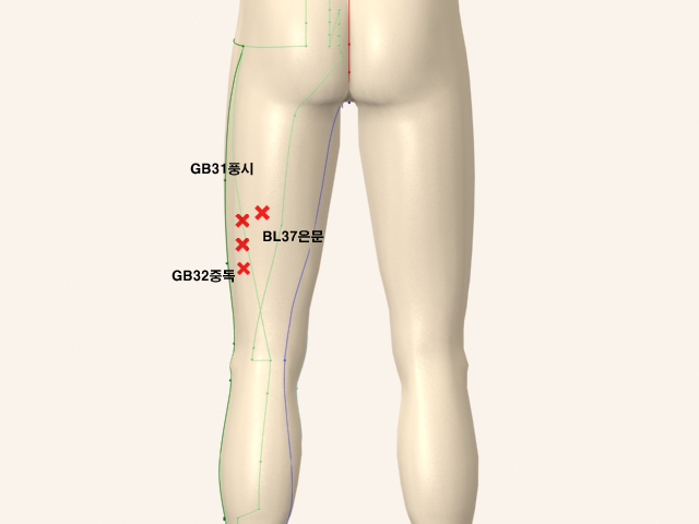 통증유발점