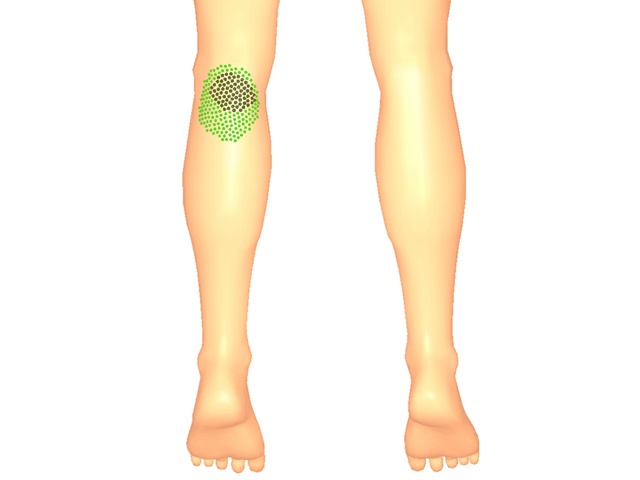 슬와근_좌