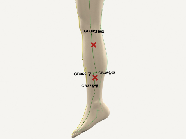  통증유발점