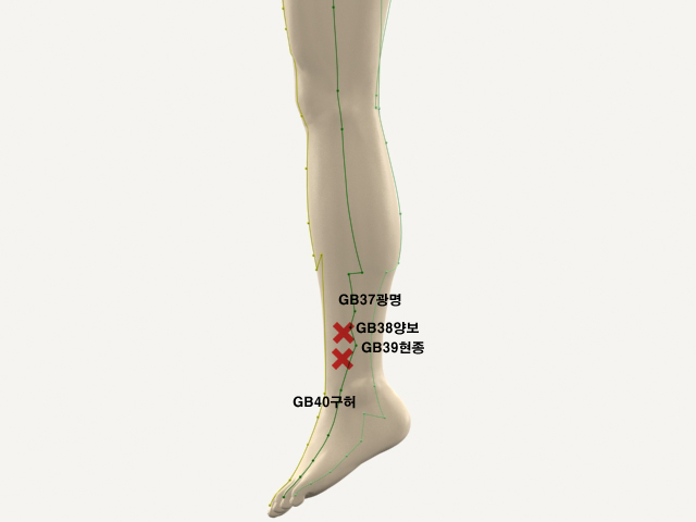 ���������������_��� 통증유발점