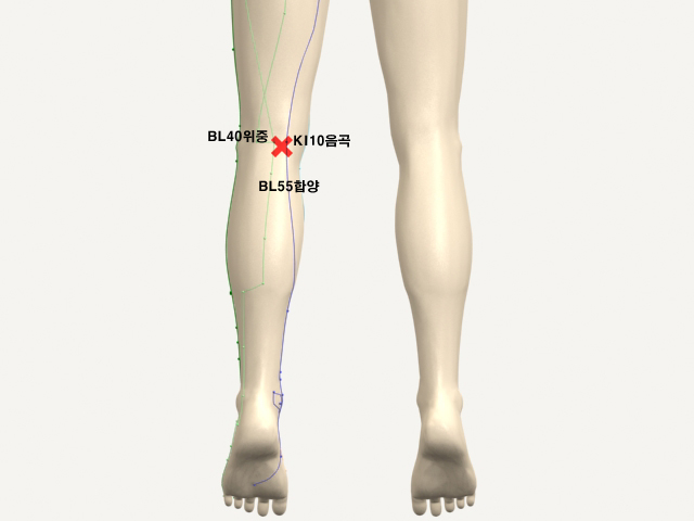  통증유발점