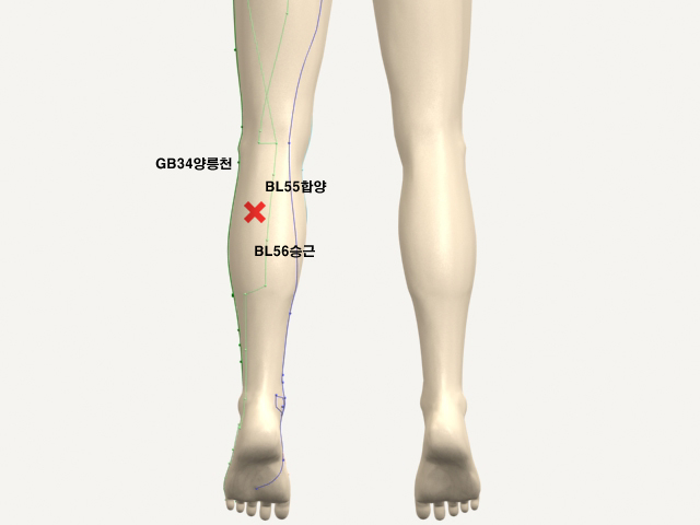 ���������(������������2)_��� 통증유발점