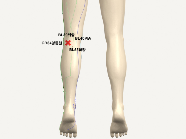 ���������(������������4)_��� 통증유발점
