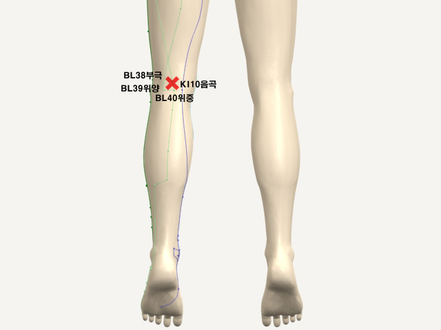 ���������_��� 통증유발점
