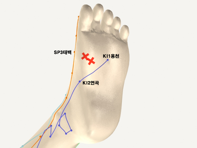  통증유발점