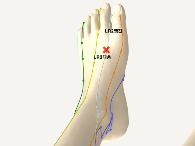  통증유발점