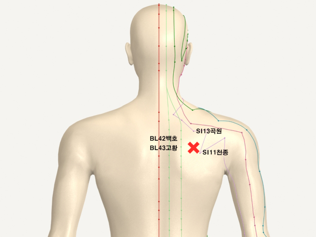 ���������(������������4)_��� 통증유발점