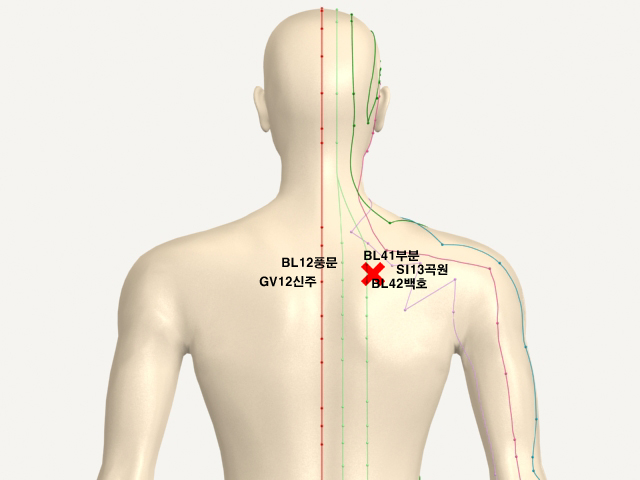���������(������������5)_��� 통증유발점