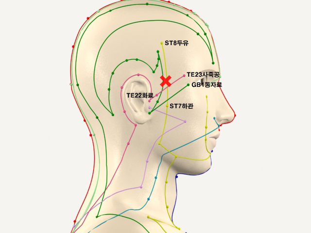 ���������(������������2)_��� 통증유발점