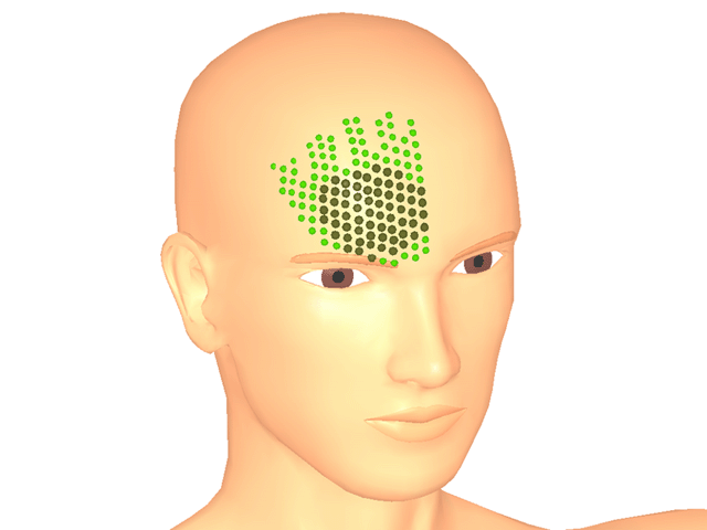 전두근_우