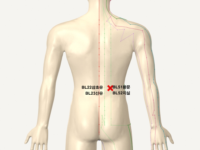 ������������(���1������)_��� 통증유발점