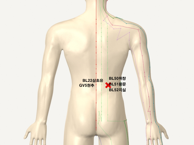 ���������������(������������������2)_��� 통증유발점