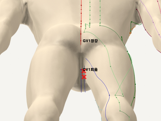 ������������_��� 통증유발점