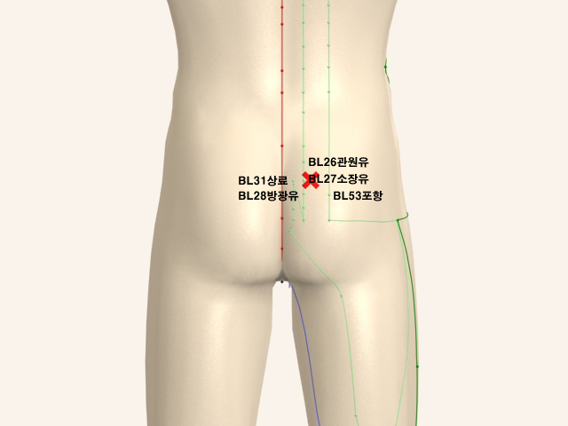 ���������(������������1)_��� 통증유발점