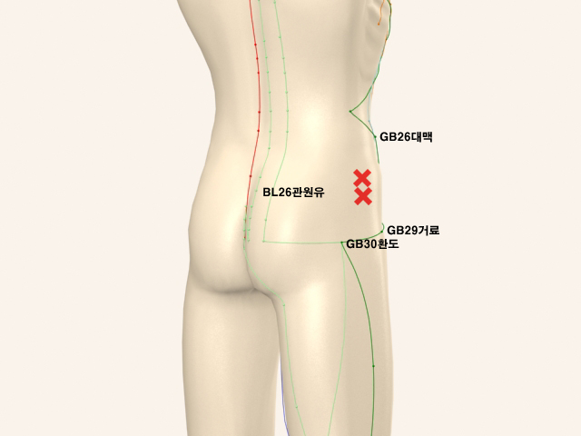 ���������(���)_��� 통증유발점