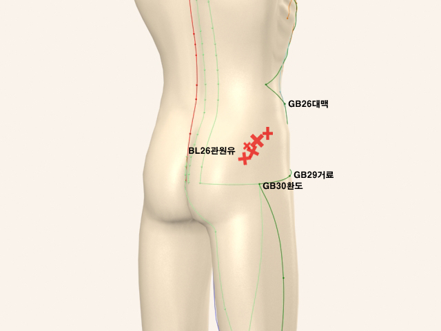 ���������(���)_��� 통증유발점