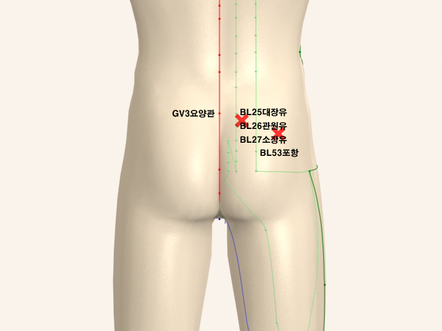 ���������_��� 통증유발점