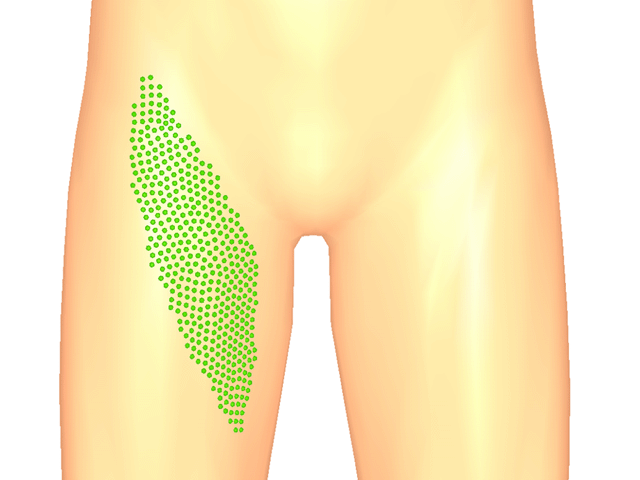 봉장근(상방아쇠점)_우