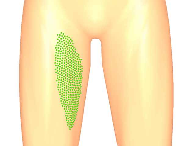 봉장근(중방아쇠점)_우