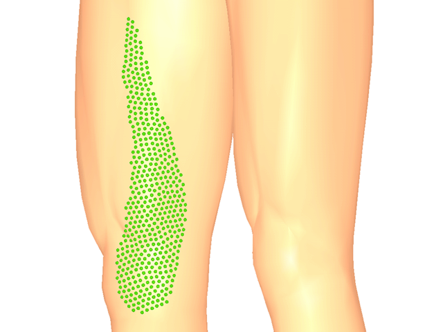 봉장근(하방아쇠점)_우