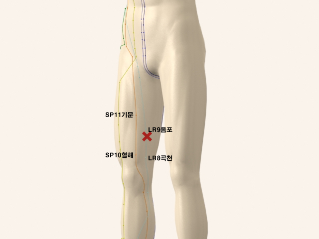  통증유발점