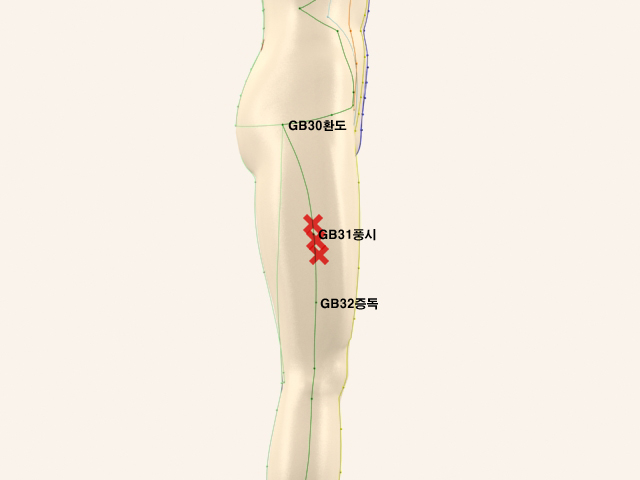 ������������(������������4)_��� 통증유발점