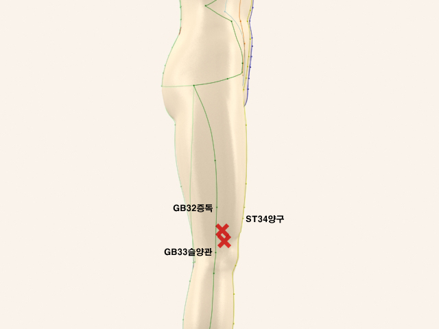 ������������(������������1)_��� 통증유발점