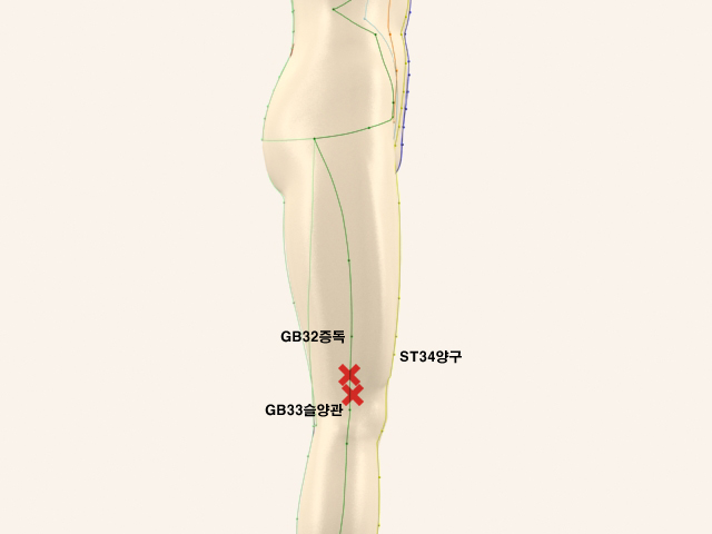 ������������(������������2)_��� 통증유발점
