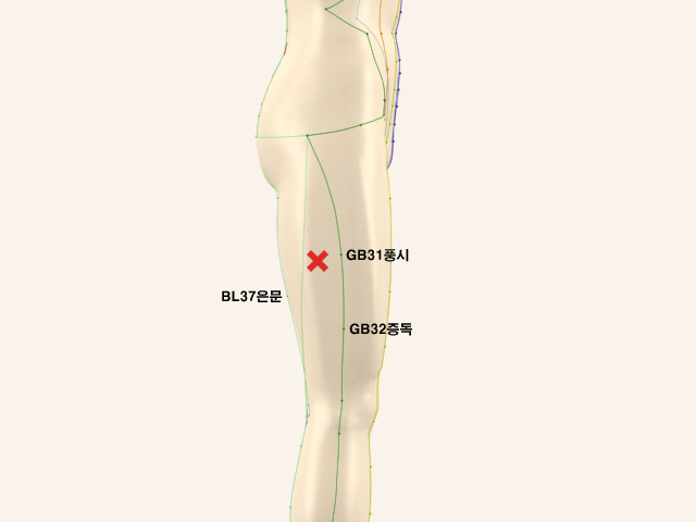 ������������(������������3)_��� 통증유발점