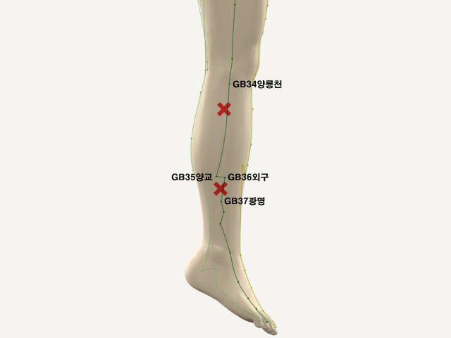  통증유발점
