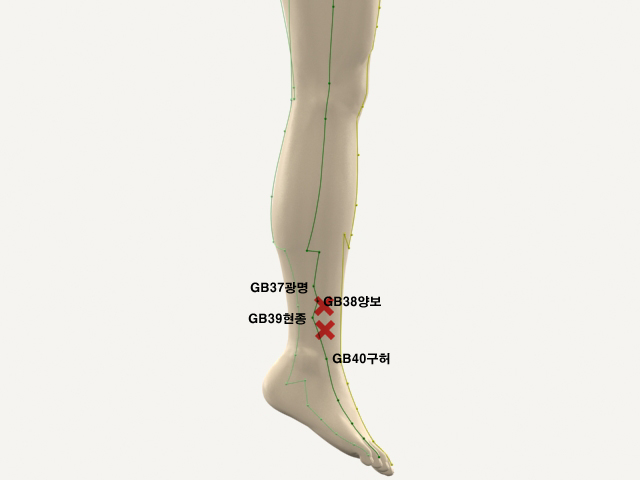 ���������������_��� 통증유발점