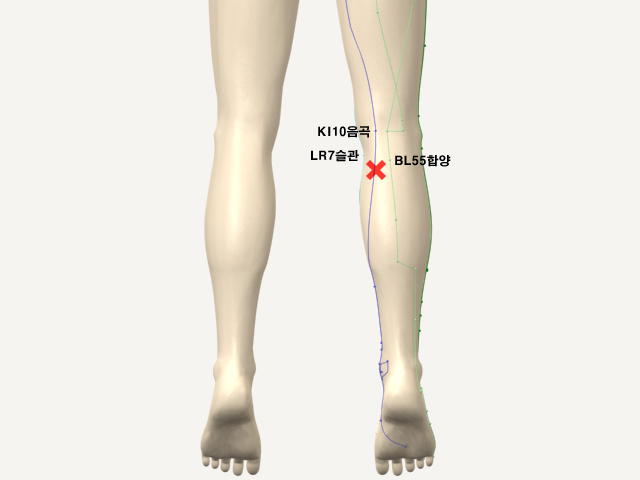  통증유발점