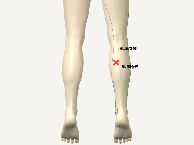 ���������������_��� 통증유발점