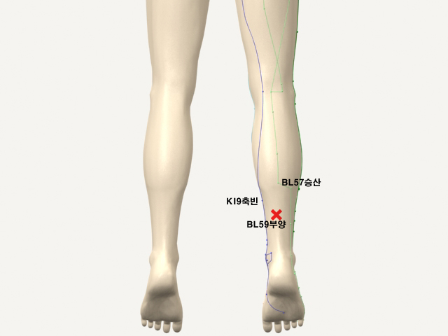 ���������������_��� 통증유발점