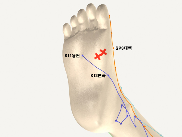 ���������������_��� 통증유발점